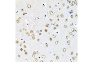 Immunohistochemistry of paraffin-embedded rat brain using RAB3IP antibody at dilution of 1:100 (x40 lens). (RAB3IP 抗体)