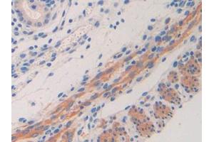 Used in DAB staining on fromalin fixed paraffin- embedded kidney tissue (IL11RA 抗体  (AA 59-217))