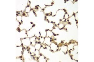 Immunohistochemistry (Paraffin-embedded Sections) (IHC (p)) image for anti-Sulfotransferase Family, Cytosolic, 2B, Member 1 (SULT2B1) (AA 1-365) antibody (ABIN6148720)
