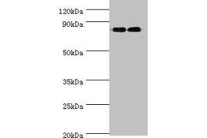 Western blot All lanes: ANAPC5 antibody at 2 μg/mL Lane 1: 293T whole cell lysate Lane 2: NIH/3T3 whole cell lysate Secondary Goat polyclonal to rabbit IgG at 1/10000 dilution Predicted band size: 86, 26, 73 kDa Observed band size: 86 kDa (ANAPC5 抗体  (AA 1-250))
