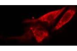 ABIN6278563 staining 293 cells by IF/ICC. (HSD17B11 抗体  (Internal Region))