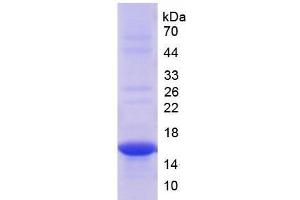 SDS-PAGE analysis of Rat THY1 Protein. (CD90 Protein (THY1))