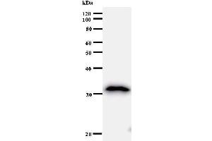 Western Blotting (WB) image for anti-B-Cell Translocation Gene 1, Anti-Proliferative (BTG1) antibody (ABIN930977) (BTG1 抗体)