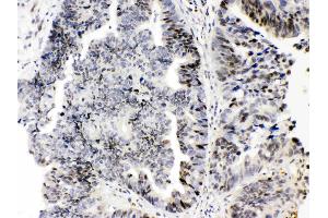 anti-E2F Transcription Factor 4, P107/p130-Binding (E2F4) (AA 106-144), (N-Term) antibody