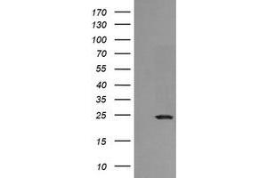 Image no. 2 for anti-RAB21, Member RAS Oncogene Family (RAB21) antibody (ABIN1500544) (RAB21 抗体)