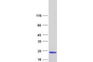Validation with Western Blot