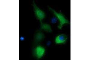 Image no. 3 for anti-butyrobetaine (Gamma), 2-Oxoglutarate Dioxygenase (Gamma-butyrobetaine Hydroxylase) 1 (BBOX1) antibody (ABIN1496815) (BBOX1 抗体)