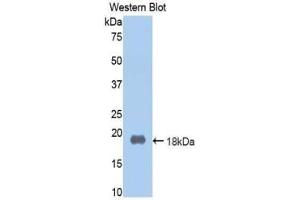 Western blot analysis of the recombinant protein. (Prothrombin 抗体  (AA 201-324))