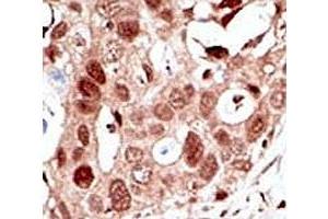 Immunohistochemistry (IHC) image for anti-Small Ubiquitin Related Modifier 2 (SUMO2) (AA 63-93) antibody (ABIN3032648)