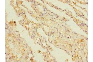 Immunohistochemistry of paraffin-embedded human lung tissue using ABIN7145856 at dilution of 1:100 (KCTD6 抗体  (AA 1-237))