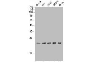 Western blot analysis of HepG2 823-AV 293T AD293 Hela lysis using PGLYRP1 antibody. (PGLYRP1 抗体  (Internal Region))