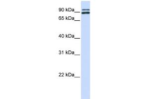 WB Suggested Anti-PCSK6 Antibody Titration: 0. (PCSK6 抗体  (N-Term))
