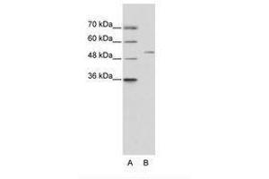 Image no. 1 for anti-Zinc Finger Protein 555 (ZNF555) (AA 25-74) antibody (ABIN6736216) (ZNF555 抗体  (AA 25-74))