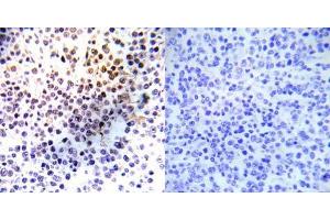 Immunohistochemical analysis of paraffin- embedded human malignant lymphoma tissue using Histone H3. (Histone H3.1 抗体)