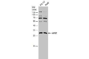 WB Image Various whole cell extracts (30 μg) were separated by 12% SDS-PAGE, and the membrane was blotted with HPRT antibody , diluted at 1:1000. (HPRT1 抗体)