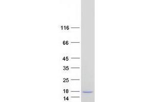Western Blotting (WB) image for S100 Calcium Binding Protein A7A (S100A7A) protein (Myc-DYKDDDDK Tag) (ABIN2731313)