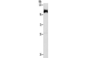 Western Blotting (WB) image for anti-Disabled Homolog 2, Mitogen-Responsive phosphoprotein (Drosophila) (DAB2) antibody (ABIN2429887) (DAB2 抗体)