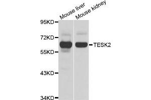 Western blot analysis of extracts of various cell lines, using TESK2 antibody (ABIN5975294) at 1/1000 dilution. (TESK2 抗体)