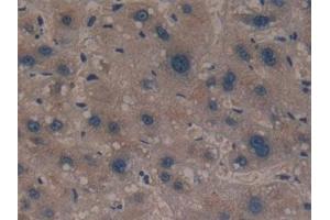 Detection of GCLM in Human Liver Tissue using Polyclonal Antibody to Glutamate Cysteine Ligase, Modifier Subunit (GCLM) (GCLM 抗体  (AA 40-251))