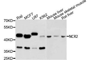 Western blot analysis of extracts of various cells, using NCR2 antibody. (NKp44/NCR2 抗体)