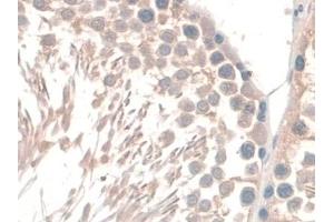 Immunohistochemistry (IHC) image for anti-Guanidinoacetate N-Methyltransferase (GAMT) (AA 2-236) antibody (ABIN7444211)