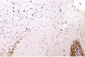 IHC analysis of hnRNP A2B1 using anti-hnRNP A2B1 antibody (ABIN5692872). (HNRNPA2B1 抗体)