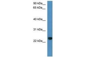 Image no. 1 for anti-Calcyphosine-Like (CAPSL) (C-Term) antibody (ABIN6746360) (CAPSL 抗体  (C-Term))