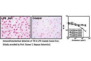 Immunohistochemical detection of TG in LPS treated mouse liver. (Thymidine Glycol 抗体)
