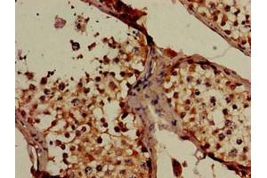 Immunohistochemistry (IHC) image for anti-Solute Carrier Family 16, Member 7 (Monocarboxylic Acid Transporter 2) (SLC16A7) (AA 197-279) antibody (ABIN7160165)