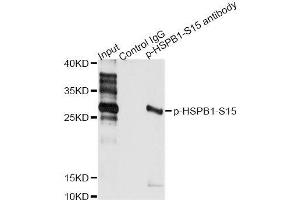 Immunoprecipitation analysis of 200 μg extracts of HeLa cells treated by EGF using 2. (HSP27 抗体  (pSer15))