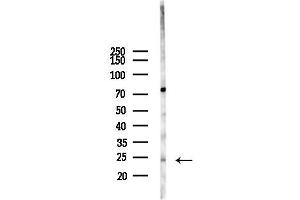 Western blot analysis of lysates from Hela cells(heat-shock 45 min treatment), using PPP1R14D Antibody at 1/1000 dilution.
