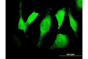 Immunofluorescence of purified MaxPab antibody to EGFR on HeLa cell. (EGFR 抗体  (AA 1-405))