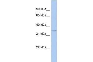WB Suggested Anti-FITM1 Antibody Titration: 0.