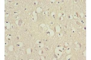Immunohistochemistry of paraffin-embedded human brain tissue using ABIN7152155 at dilution of 1:100 (EIF3F 抗体  (AA 88-357))
