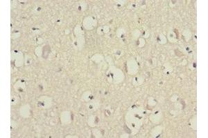 Immunohistochemistry of paraffin-embedded human brain tissue using ABIN7152155 at dilution of 1:100 (EIF3F 抗体  (AA 88-357))