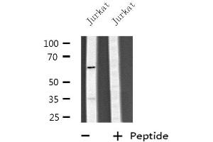 Western blot analysis of extracts from Jurkat cells, using CYP4V2 antibody. (CYP4V2 抗体  (Internal Region))