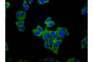 Immunofluorescence staining of HepG2 cells with ABIN7152382 at 1:66, counter-stained with DAPI. (F-Actin-Uncapping Protein LRRC16A (CARMIL1) (AA 1184-1295) 抗体)