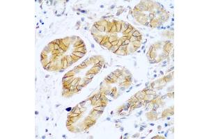 Immunohistochemistry of paraffin-embedded human stomach using NCAM1 antibody (ABIN5975670) at dilution of 1/100 (40x lens). (CD56 抗体)