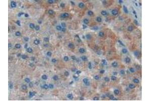 Detection of IkBd in Human Liver Tissue using Polyclonal Antibody to Inhibitory Subunit Of NF Kappa B Delta (IkBd)