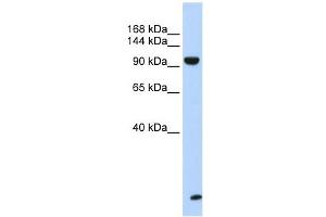 TNRC6B antibody used at 1 ug/ml to detect target protein. (TNRC6B 抗体  (N-Term))