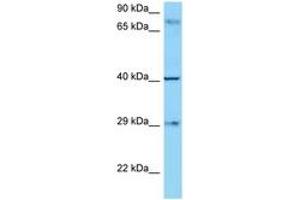Image no. 1 for anti-CD274 (PD-L1) (AA 192-241) antibody (ABIN799508) (PD-L1 抗体  (AA 192-241))