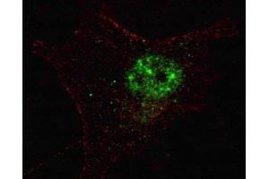 Fluorescent confocal image of SY5Y cells stained with PDX1 antibody. (PDX1 抗体  (AA 1-30))