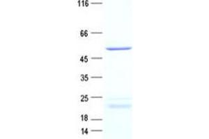 Western Blotting (WB) image for Calcium/calmodulin-Dependent Protein Kinase II delta (CAMK2D) protein (DYKDDDDK Tag) (ABIN2713092)
