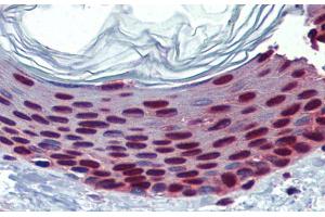 Immunohistochemistry with Human Skin lysate tissue at an antibody concentration of 5. (SLC35A5 抗体  (N-Term))