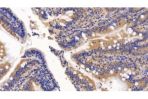 Detection of a2M in Porcine Small intestine Tissue using Polyclonal Antibody to Alpha-2-Macroglobulin (a2M) (alpha 2 Macroglobulin 抗体  (AA 616-856))