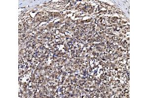 IHC analysis of NOLA1/GAR1 using anti-NOLA1/GAR1 antibody (ABIN7602076).