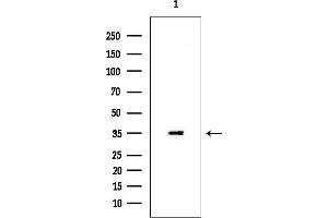Western blot analysis of lysates from EC304 cells(heat-shock treatment), using MARCH3 Antibody at 1/1000 dilution.