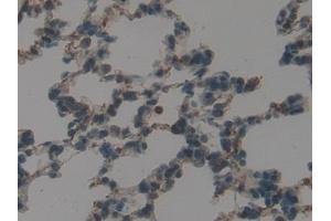 Detection of GATA4 in Rat Lung Tissue using Polyclonal Antibody to GATA Binding Protein 4 (GATA4) (GATA4 抗体  (AA 228-440))