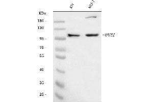Western blot analysis of Dynamin 2/DNM2 using anti-Dynamin 2/DNM2 antibody (ABIN7601862).