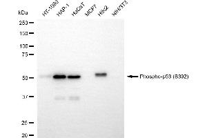 Western blotting analysis using phospho-p53 (S392) antibody (ABIN7800681).